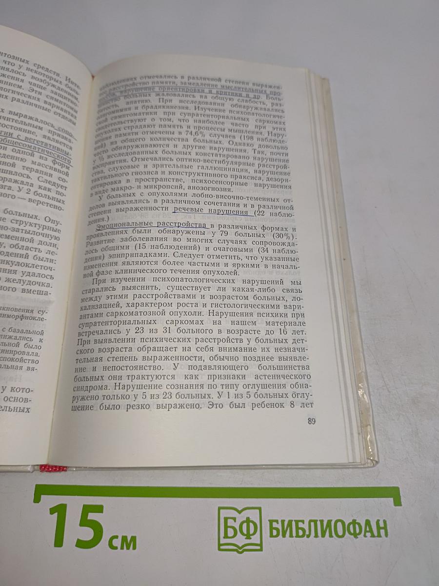 Саркомы головного мозга