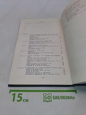 Варикозная болезнь