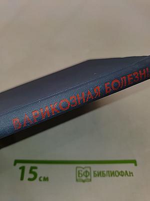 Варикозная болезнь