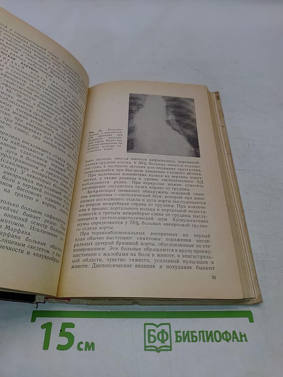 Клиническая ангиология