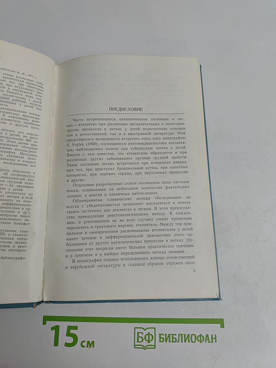 Рентгенодиагностика ателектазов легких у детей