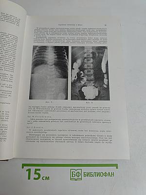 Pamiętnik I Zjazdu Naukowego Polskiego Towarzystwa Chirurgów Dziecięcych 1967