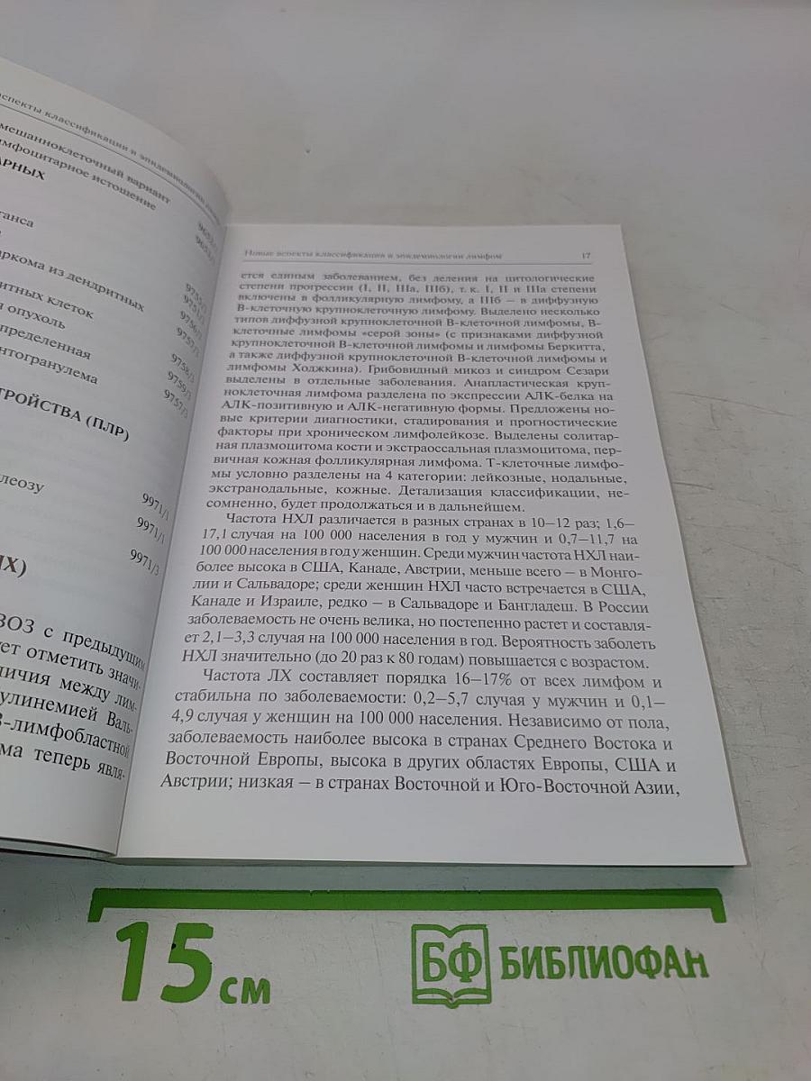 Лимфомы