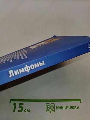 Лимфомы