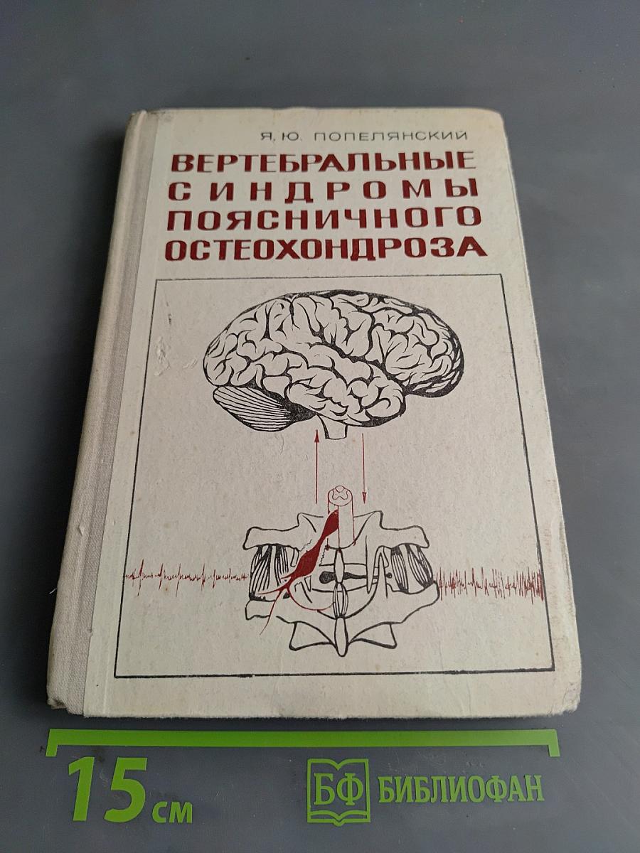 Вертебральные синдромы поясничного остеохондроза