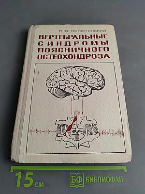 Вертебральные синдромы поясничного остеохондроза