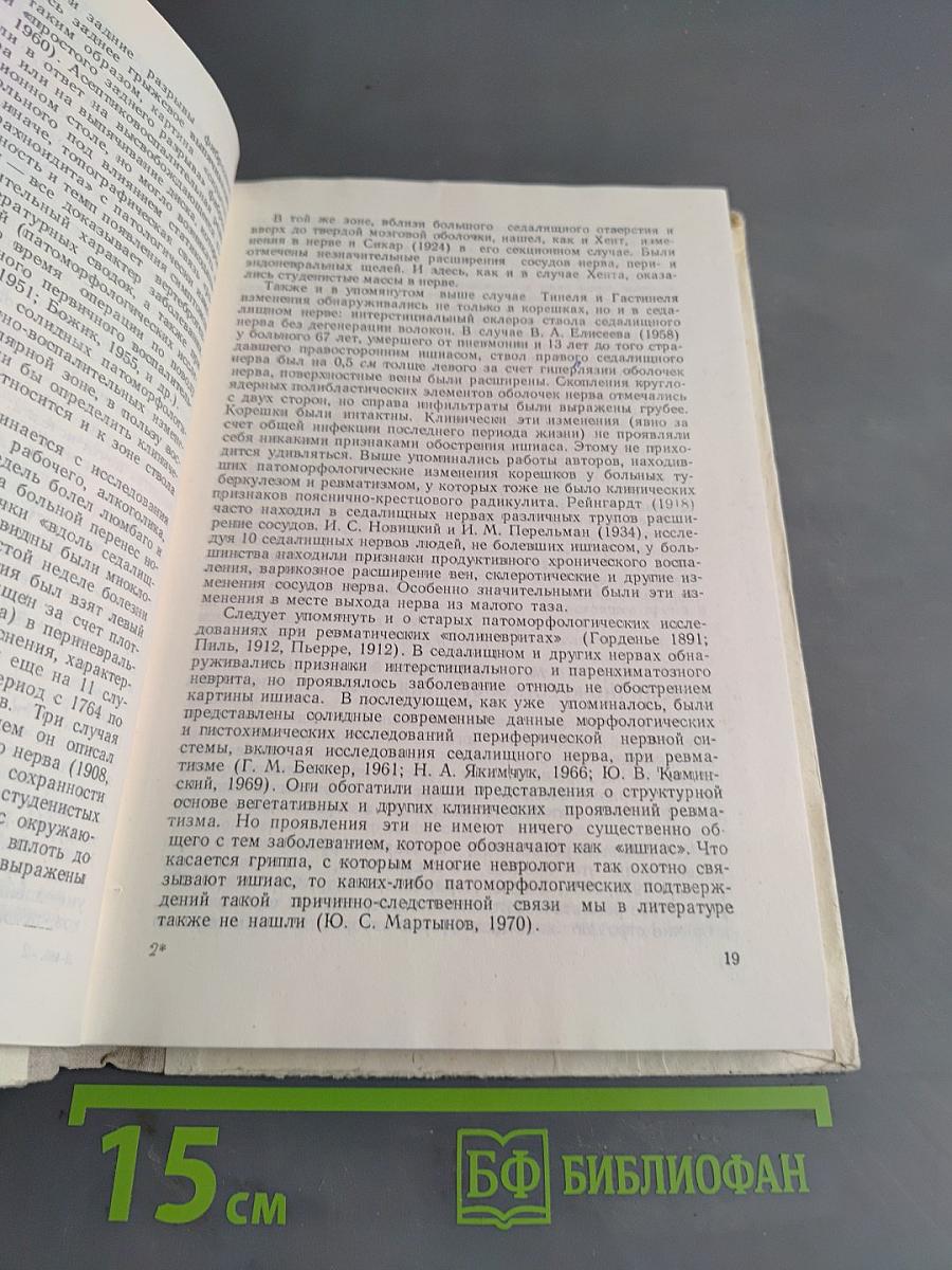 Вертебральные синдромы поясничного остеохондроза