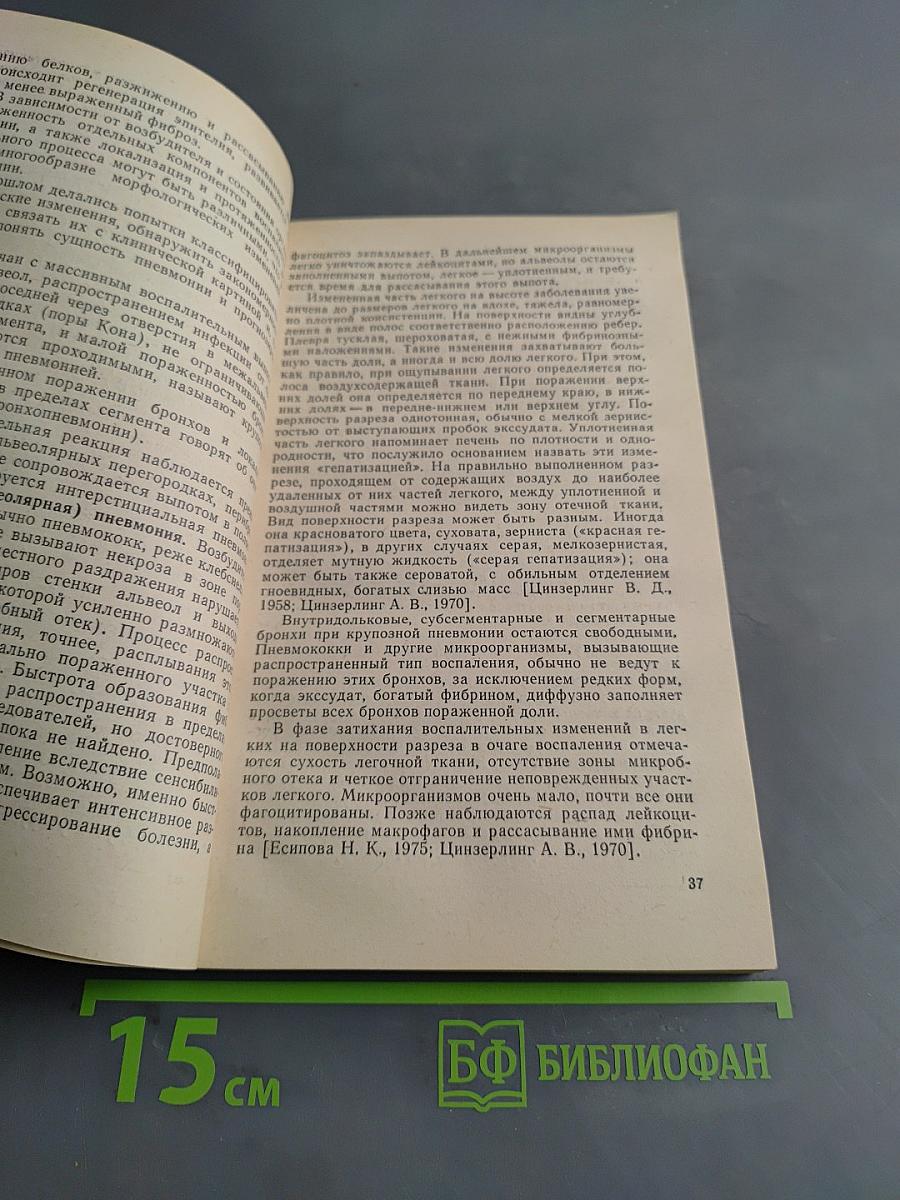 Пневмония