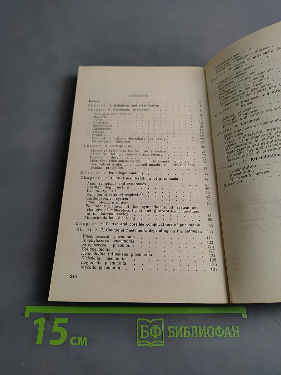 Пневмония
