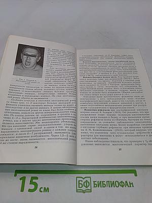 Наследственные формы миотонии и миотонические синдромы