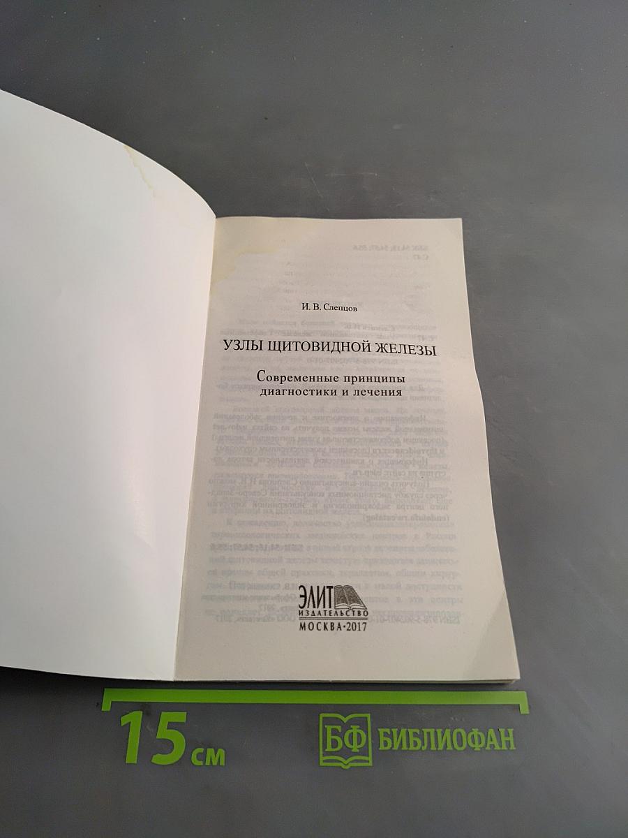 Узлы щитовидной железы. Современные принципы диагностики и лечения