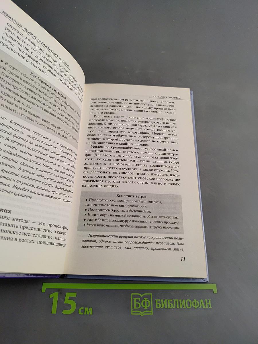 Ревматизм. Лечение, профилактика, питание