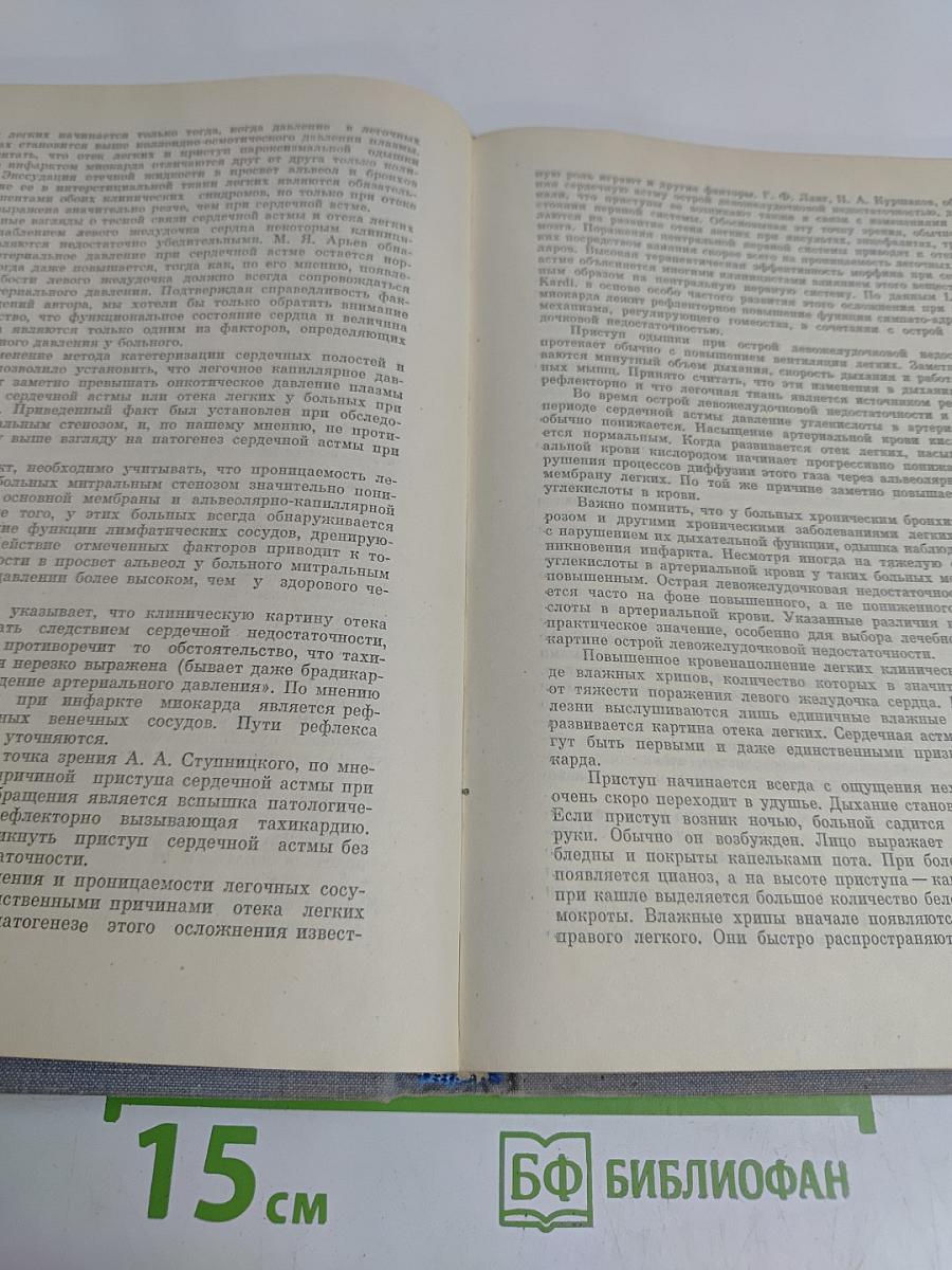 Инфаркт миокарда