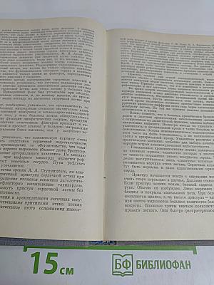 Инфаркт миокарда
