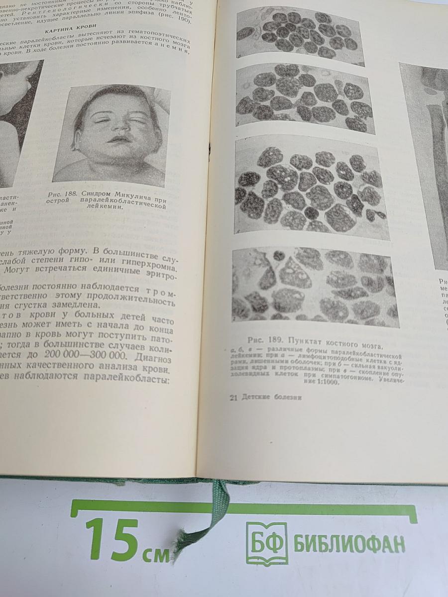 Руководство по детским болезням