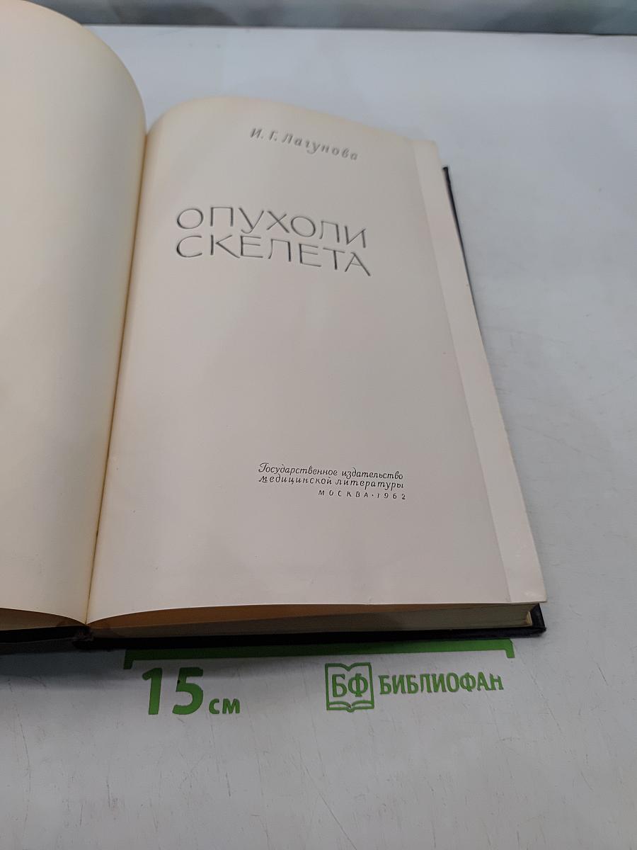 Опухоли скелета