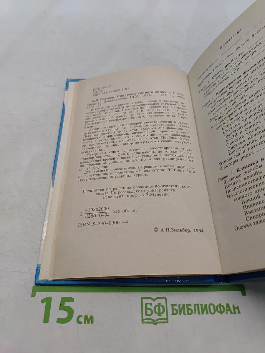 Синдромы сонного апноэ