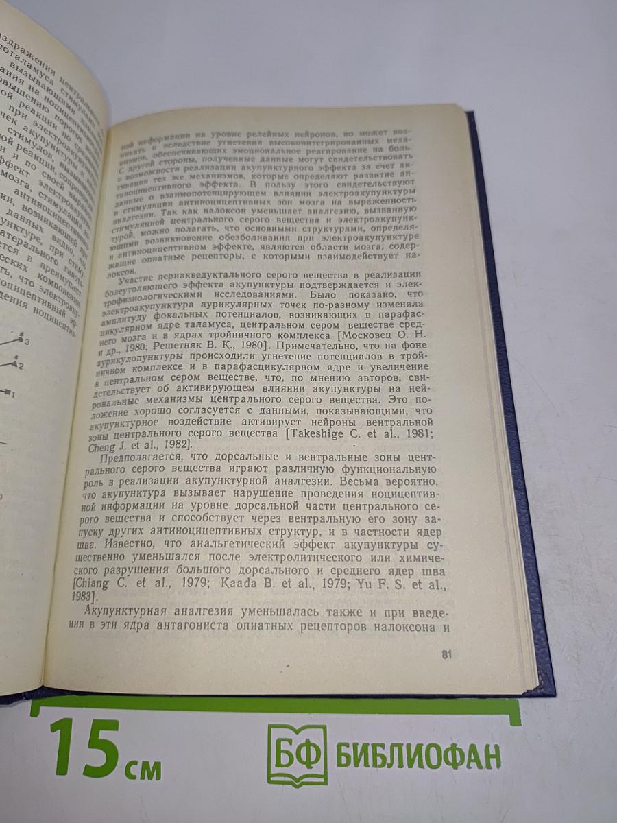 Акупунктурная анальгезия. Экспериментально-клинические аспекты