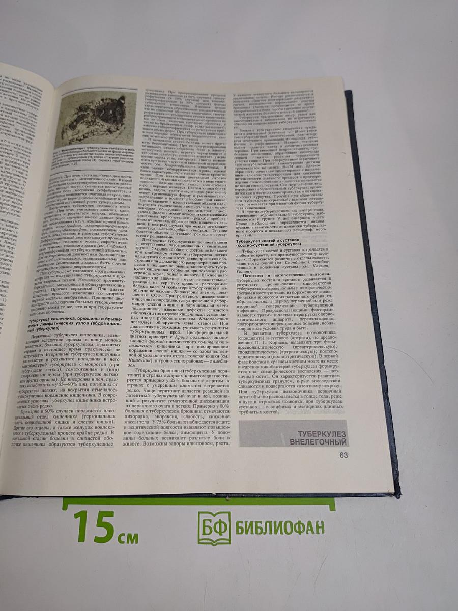 Малая медицинская энциклопедия. Том 6. Токсины — Ящур
