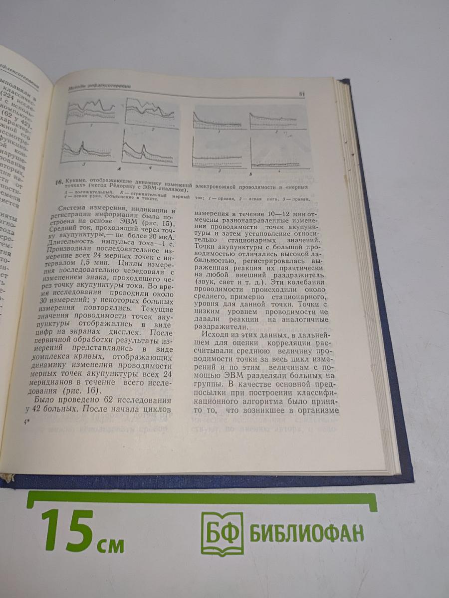 Рефлексотерапия в клинической анестезиологии