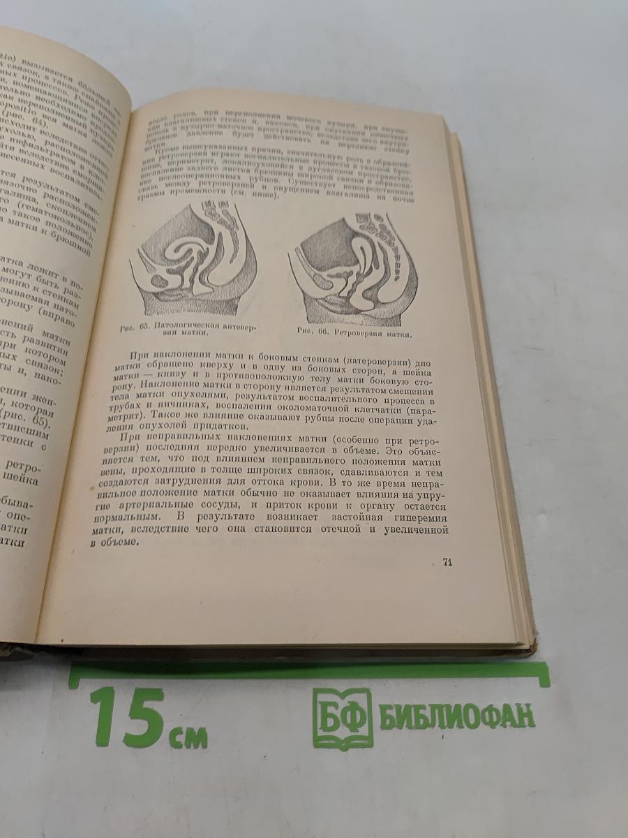Учебник гинекологии