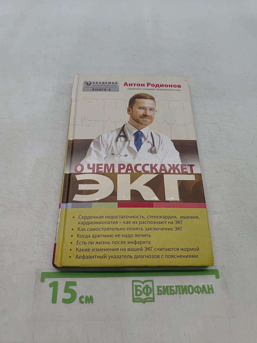 О чем расскажет ЭКГ
