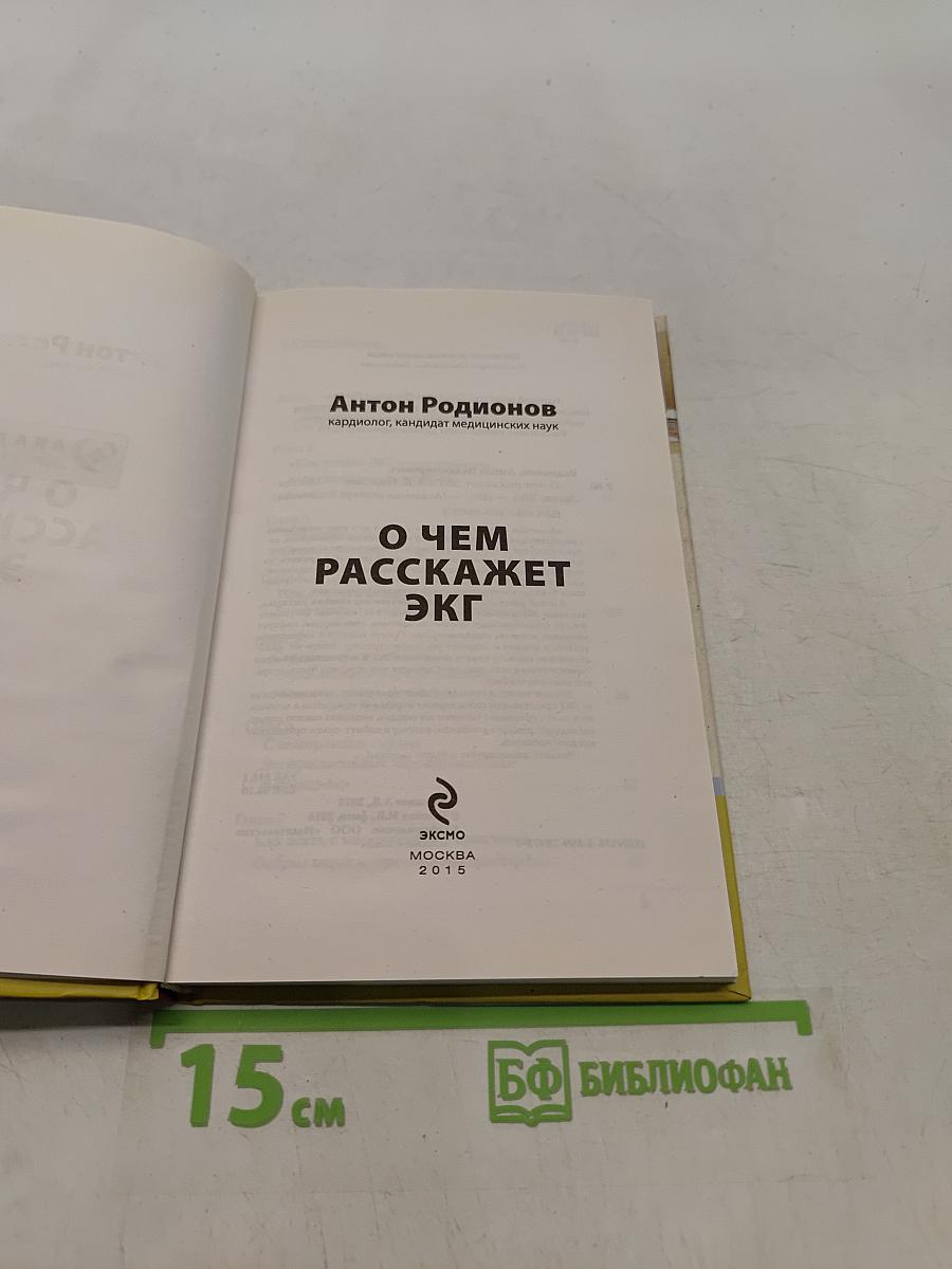 О чем расскажет ЭКГ