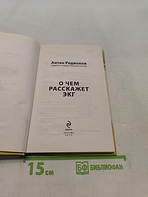 О чем расскажет ЭКГ