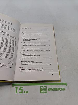 О чем расскажет ЭКГ