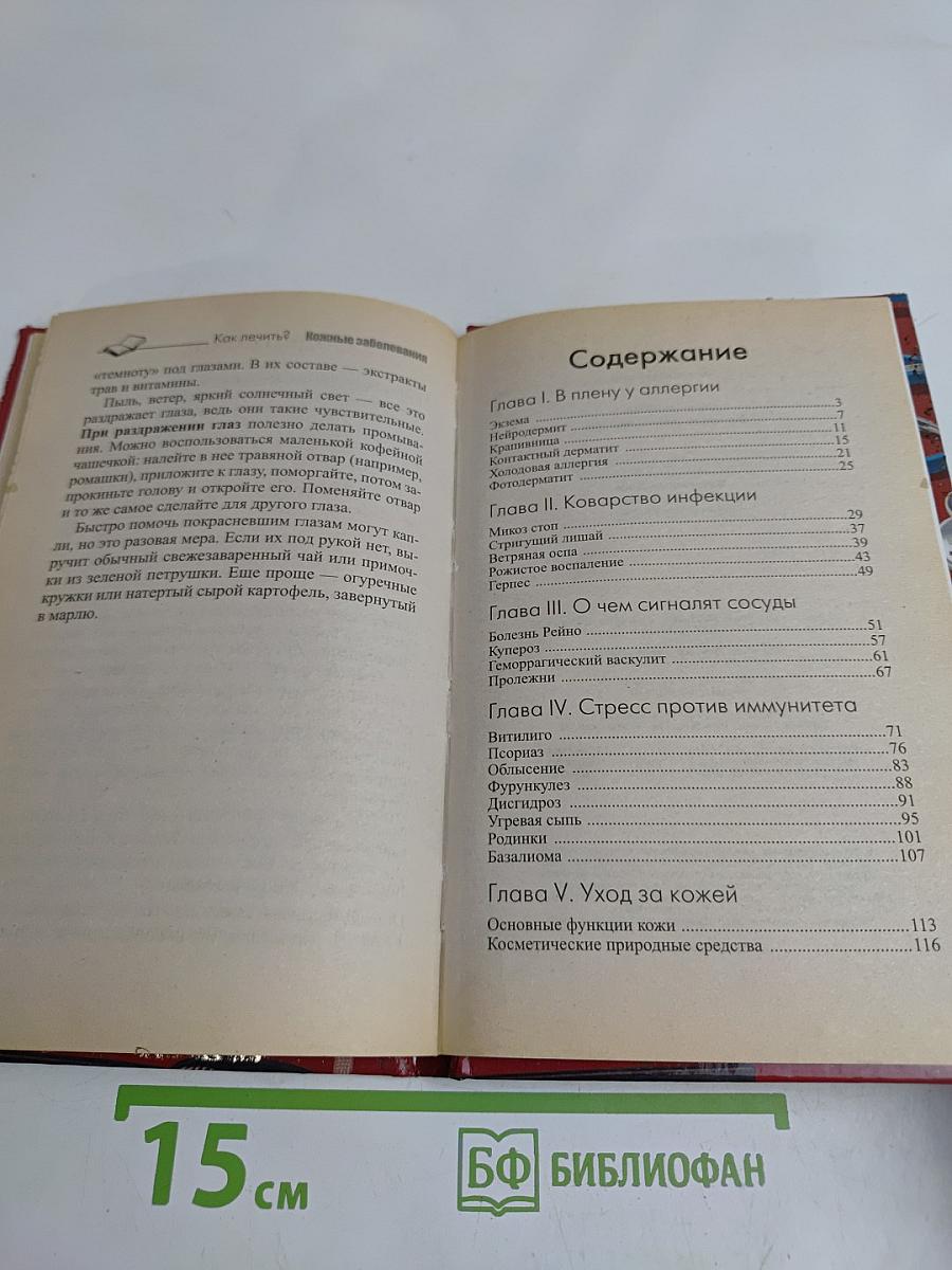 Кожные заболевания. Что советуют врачи