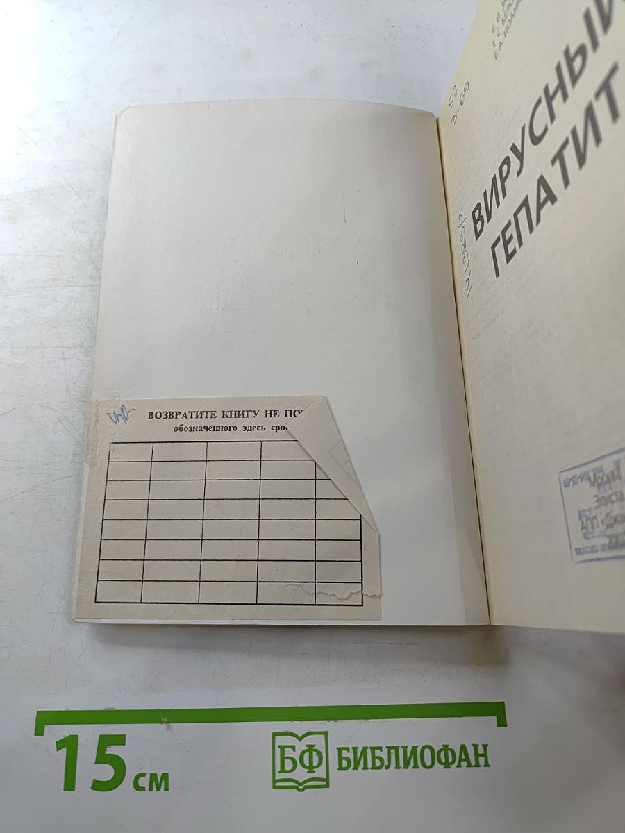 Вирусный гепатит