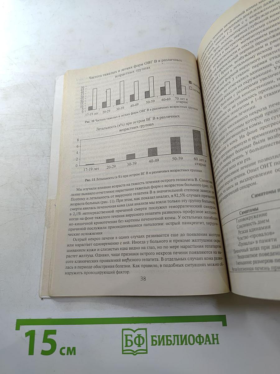 Вирусный гепатит