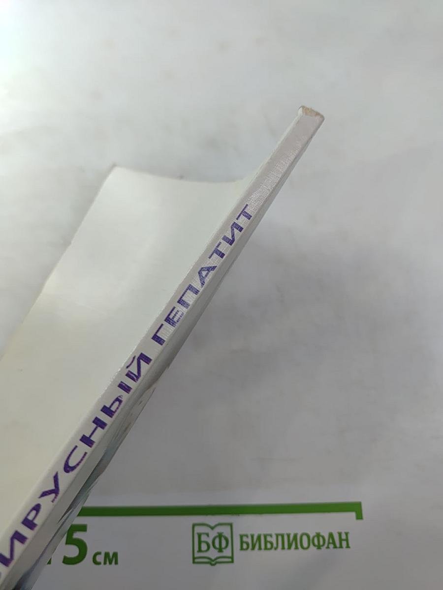 Вирусный гепатит