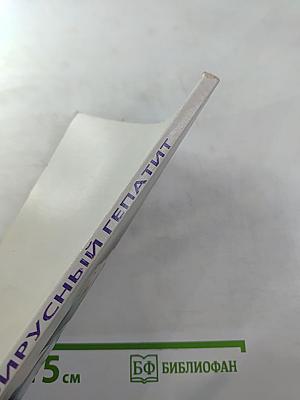 Вирусный гепатит