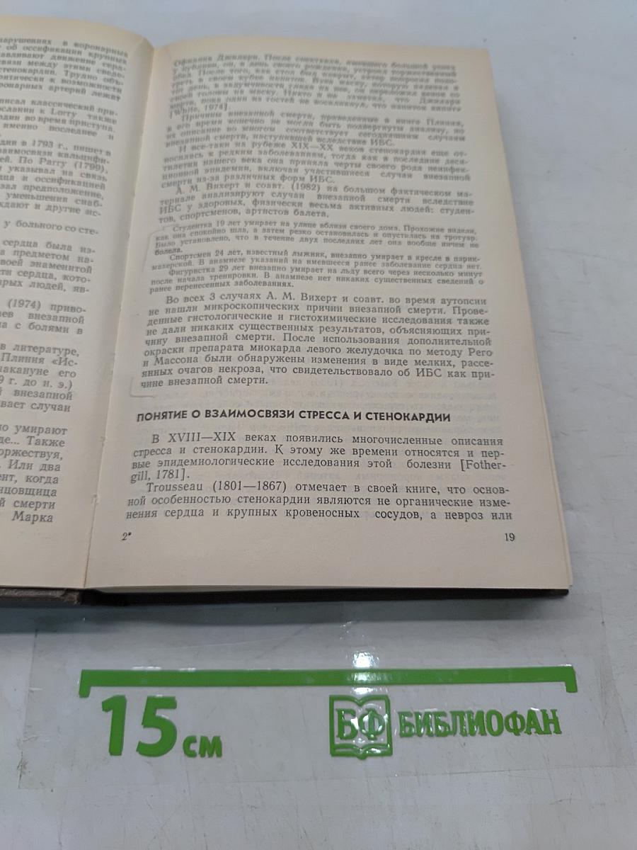 Стенокардия