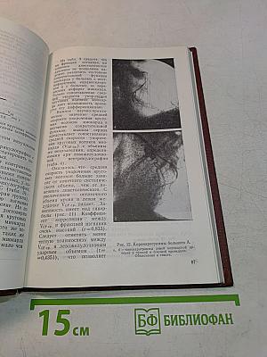 Начальная стадия сердечной недостаточности
