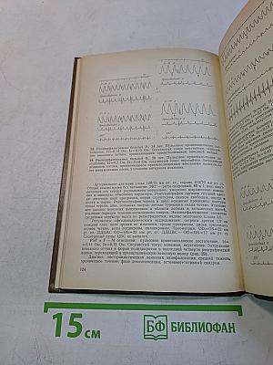 Венозная дисциркуляторная патология головного мозга