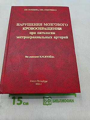 Нарушения мозгового кровообращения при патологии экстракраниальных артерий