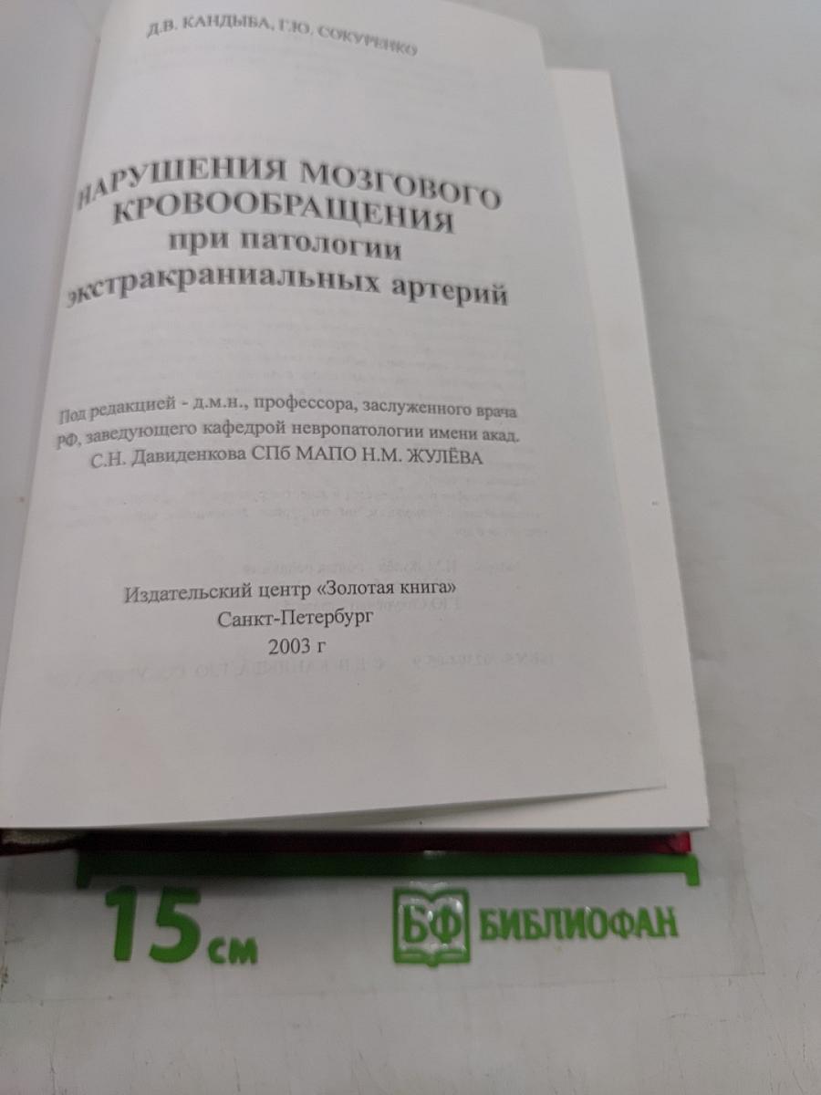 Нарушения мозгового кровообращения при патологии экстракраниальных артерий
