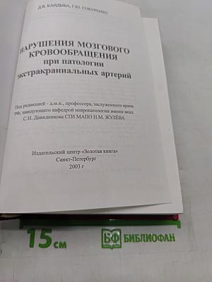 Нарушения мозгового кровообращения при патологии экстракраниальных артерий