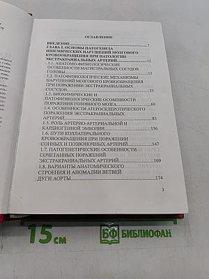 Нарушения мозгового кровообращения при патологии экстракраниальных артерий