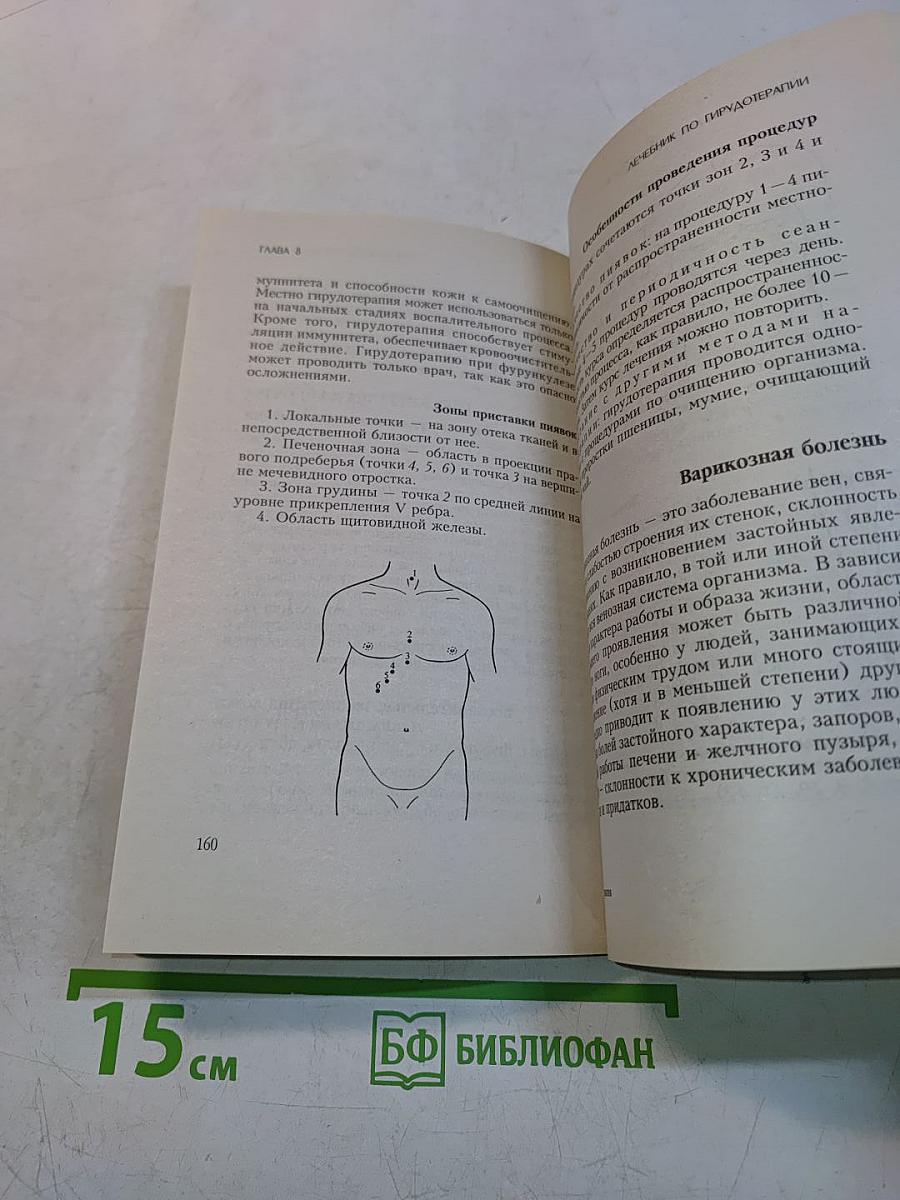 Вам поможет пиявка