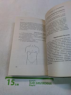 Вам поможет пиявка