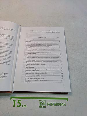 Полигепатография. Гемодинамика. Гепатит