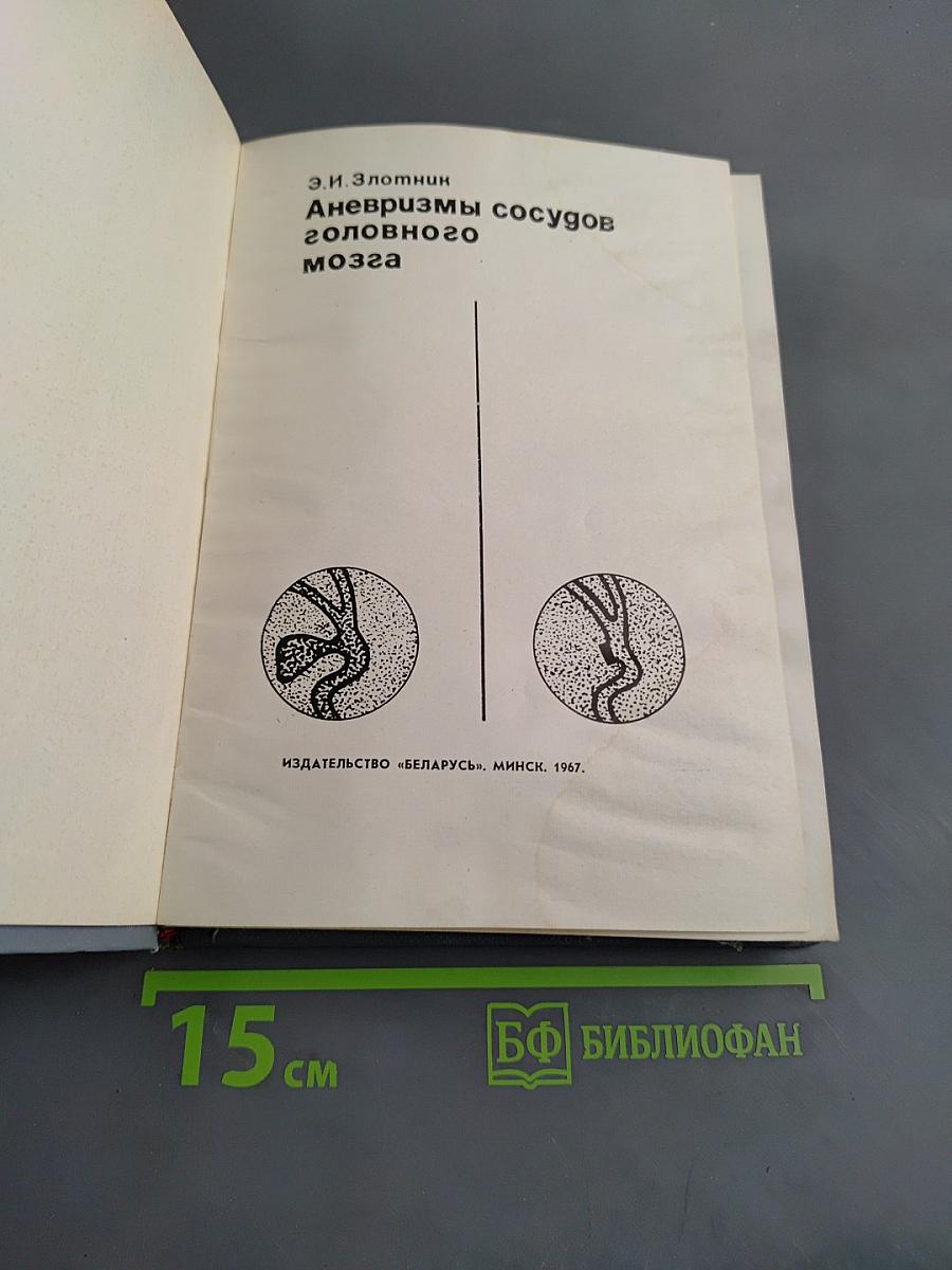 Аневризмы сосудов головного мозга