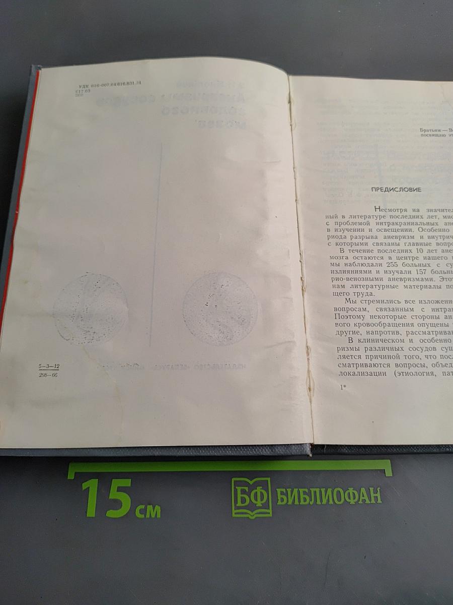 Аневризмы сосудов головного мозга
