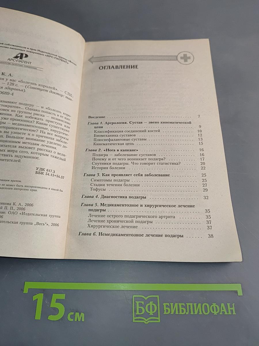 Подагра. Если у вас «болезнь королей»