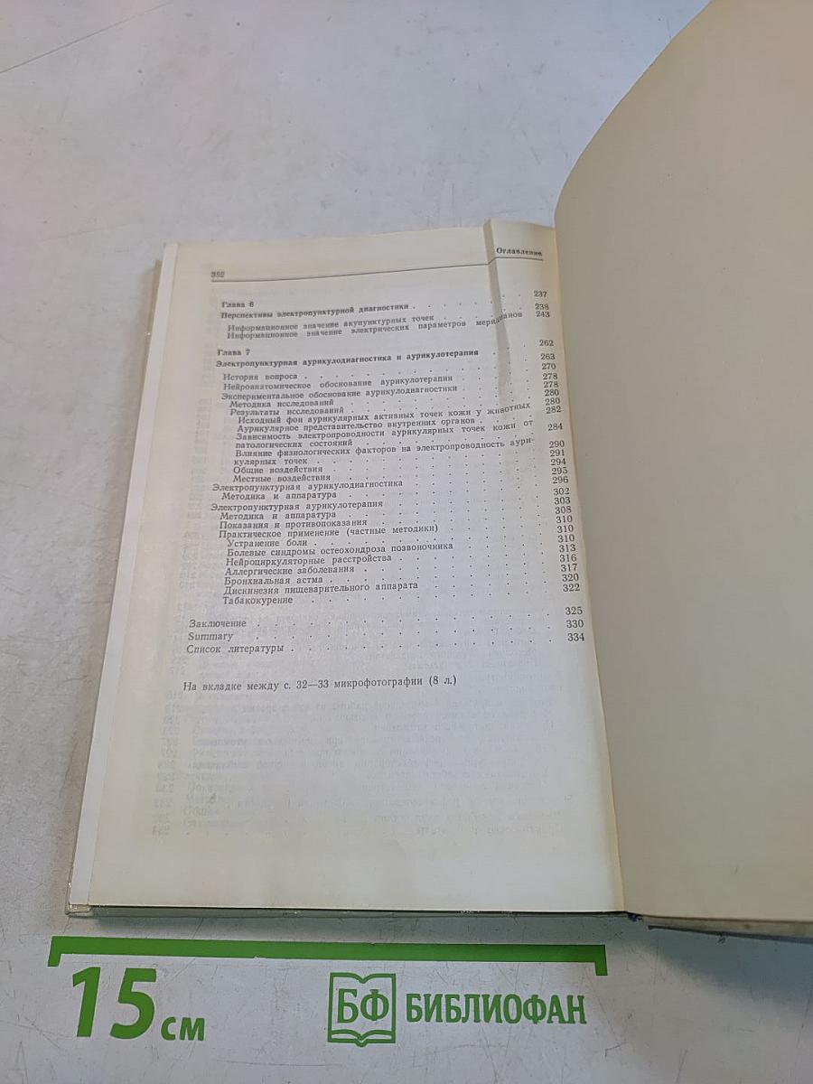 Электропунктурная рефлексотерапия