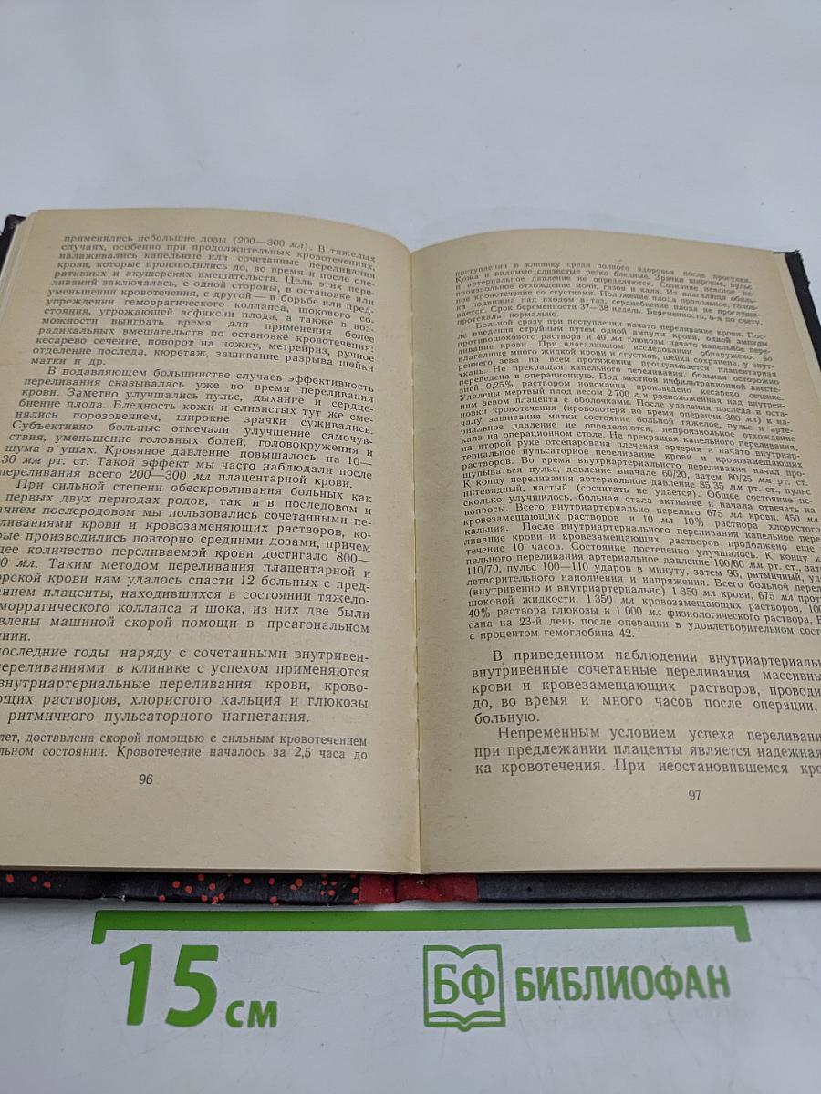 Переливание крови в акушерской практике