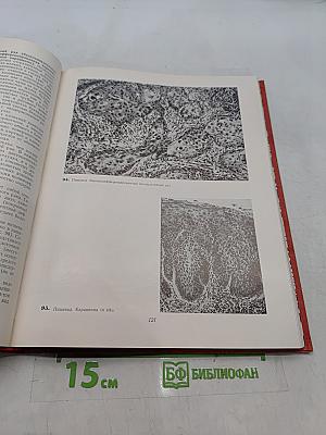 Атлас опухолей человека